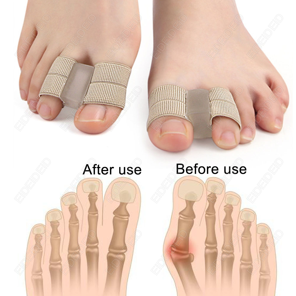 Bunion toe Corrector Orthotics - đánh giá và giá Women'S Shoes With Bunions